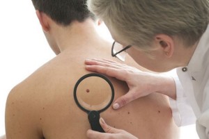 DoctorMelanoma101115sk